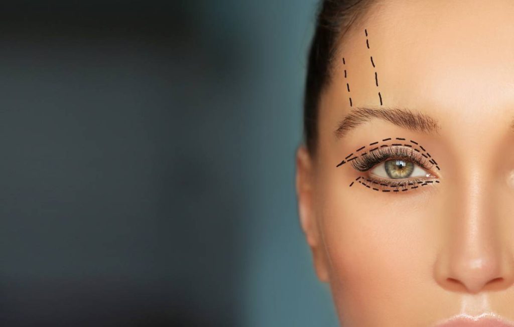 benefits-modern-eyelid-surgery