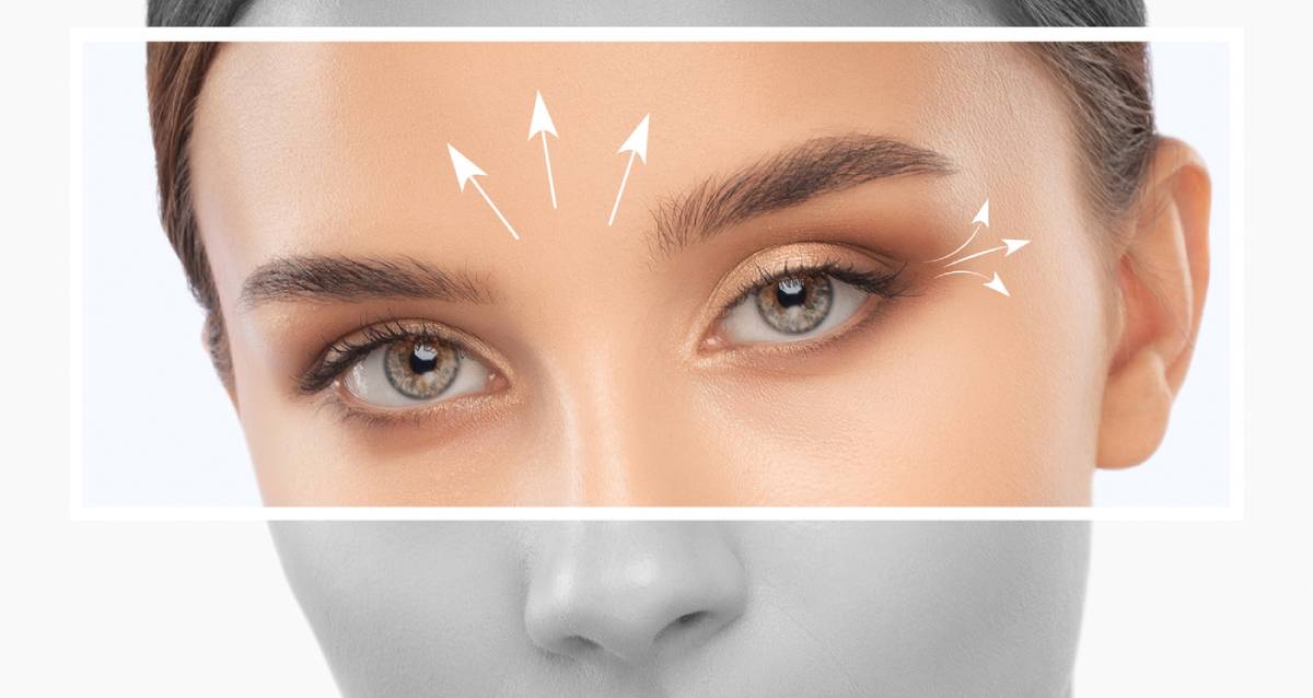 Featured image for How Long Do the Results of a Brow Lift Last