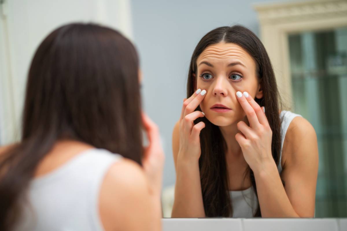 Woman looking at her dark circles.